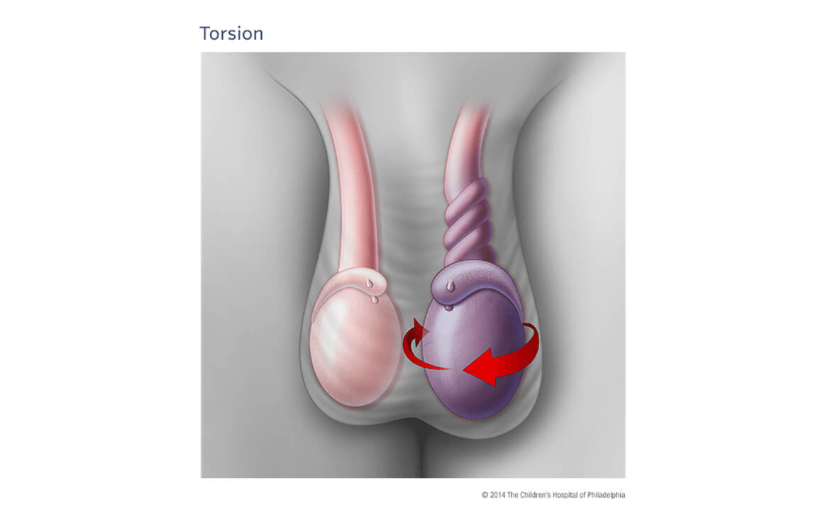 Best Pediatric Urologist in India, Robotic pediatric urology